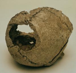 Ballateare Viking Burial Female Human Skull